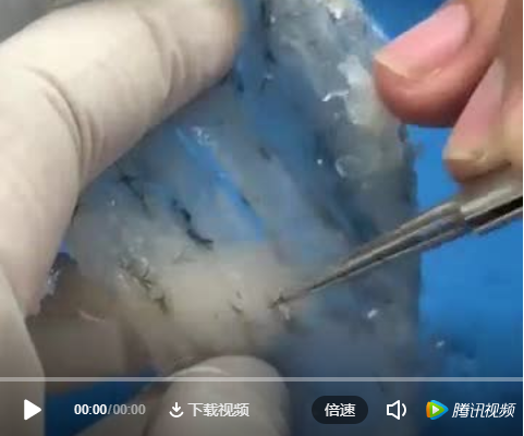 傳統(tǒng)挑毛視頻